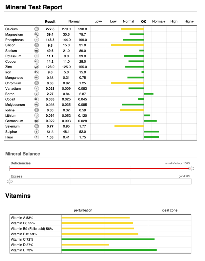 Oligoscan Minerals report